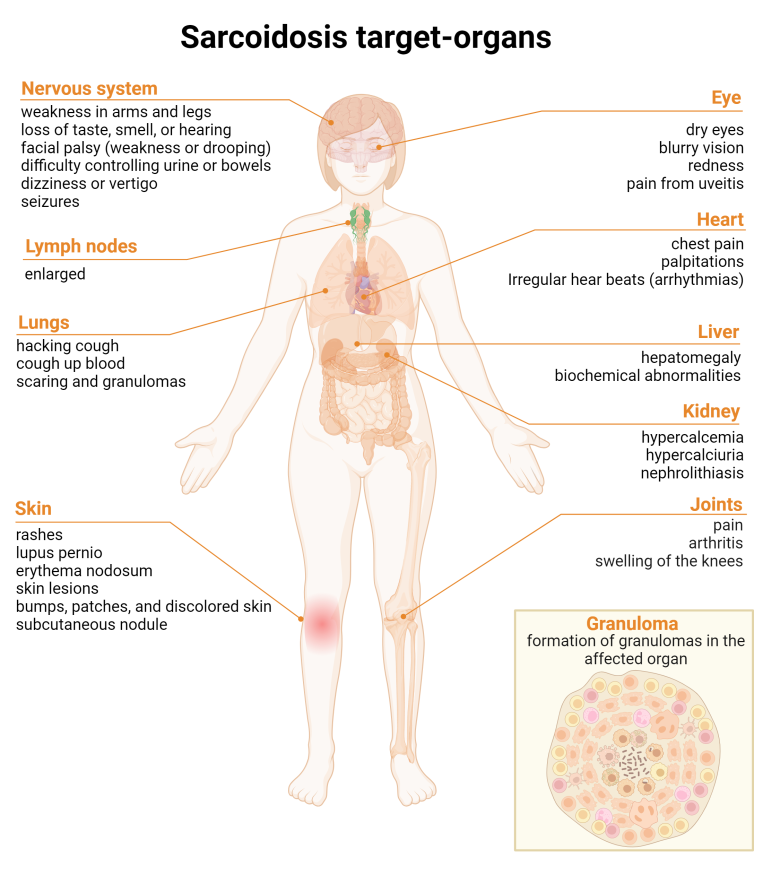 sarko_target_organs